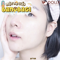 Mặt Nạ Giấy Banobagi Vita Genic Jelly Mask Hydrating 30ml