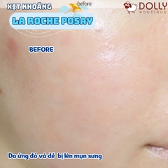 Xịt Khoáng Làm Sạch & Giảm Bóng Nhờn La Roche-Posay Serozinc 300ml