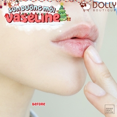 Sáp Dưỡng Môi Hồng Xinh Vaseline Lip Therapy Rosy Lip (7g)