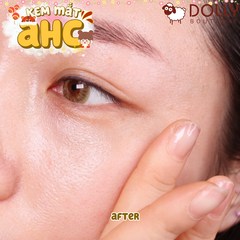 [Mới 2022] Kem mắt AHC Aesthetic Care Ten Revolution Real Eye Cream For Face 30ml