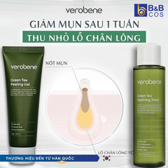 Gel Tẩy Tế Bào Chết Trà Xanh 70g - Chính hãng Hàn Quốc (mẫu mới)