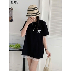 18386- A.Thun tay Ren Nơ- 00288