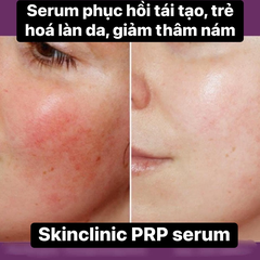 Serum PRP Skin Clinic siêu phục hồi đỉnh cao 30ml