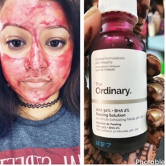 Serum tẩy tế bào chết hoá học The Ordinary AHA 30%+ BHA 2% Peeling Solution