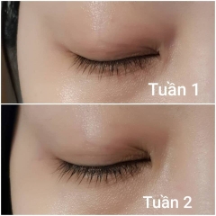 Serum kích mi mọc dài và dày EyEnvy tốt nhất tại Canada