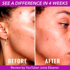 Tinh Chất làm đều màu da Good Molecules Discoloration Correcting Serum -