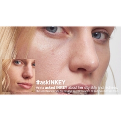 Serum dưỡng da làm mờ thâm mụn Niacinamide The INKEY List kiểm soát dầu