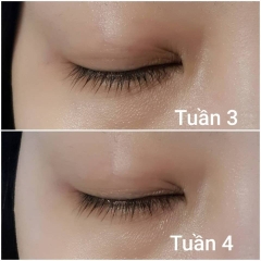 Serum kích mi mọc dài và dày EyEnvy tốt nhất tại Canada