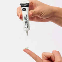 Gel Chấm Mụn The Inkey List Succinic Acid Acne Treatment 15ml