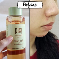 [250 ML] Nước hoa hồng Pixi Glow Tonic 5% Glycolic Acid Exfoliating Toner
