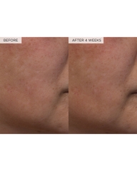 Nước Hoa Hồng Giúp Giảm Lỗ Chân Lông Glow Recipe Watermelon Glow PHA + BHA Pore-Tight Toner 150ML