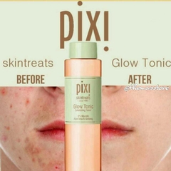 [250 ML] Nước hoa hồng Pixi Glow Tonic 5% Glycolic Acid Exfoliating Toner