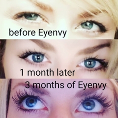 Serum kích mi mọc dài và dày EyEnvy tốt nhất tại Canada