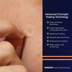 Miếng Dán Mụn Panoxyl PM Overnight Spot Patches 40 Miếng