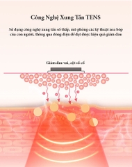 Máy massage cổ 3D thông minh KD811A sử dụng xung điện tần tenst, điều khiển từ xa