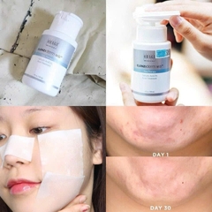 Toner BHA Obagi Clenziderm MD Pore Therapy 2% giảm mụn, dầu nhờn, 148ml