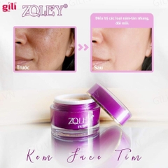 Kem dưỡng trắng Zoley Anti Wrinkles Skin Tím SPF30+ 10gr chính hãng