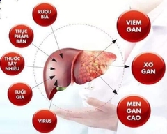 Nước Uống Bổ Gan Đỏ Hepalyse II Nhật Bản