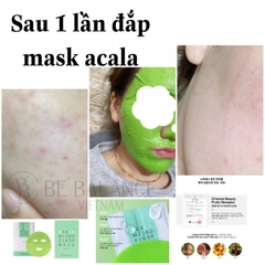 BE BALANCE. Mặt Nạ Giấy Acala Xanh Lá