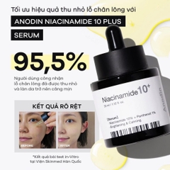 Serum làm trắng và thu nhỏ lỗ chân lông Anodin Niacinamide 10 Plus 33ml