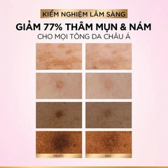 Tinh Chất L'Oreal Paris Dưỡng Sáng Da Glycolic-Bright Anti-Dark Spot Brightening Serum 30ml