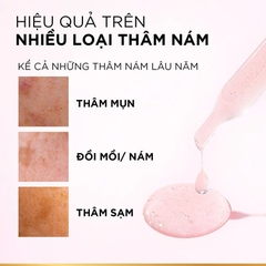 Tinh Chất L'Oreal Paris Dưỡng Sáng Da Glycolic-Bright Anti-Dark Spot Brightening Serum 30ml