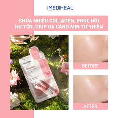 Mặt Nạ Ngăn Ngừa Lão Hóa Da Mediheal Collagen Essential Mask 24ml
