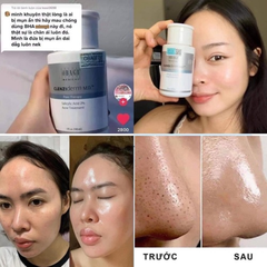 Toner OBAGI 2% BHA chiết 30ml