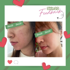 Set thu nhỏ lỗ chân lông ZO Skin Health