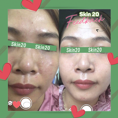 Tinh chất cấp nước phục hồi da Obagi Daily Hydro Drops