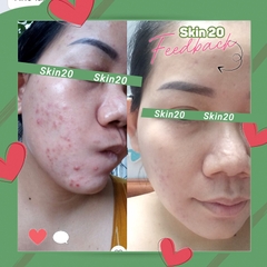 Kem dưỡng Obagi Clenziderm M.D. Therapeutic Moisturizer - 50ml