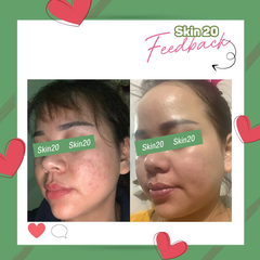 Kem dưỡng phục hồi làm dịu da Obagi Kinetin Hydrating Cream - 50ml