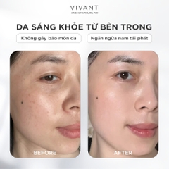 Tinh chất giảm nám, tàn nhang và cải thiện da sáng mịn Vivant Skincare True Tone 2.0 - 30ml