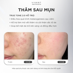 Tinh chất giảm nám, tàn nhang và cải thiện da sáng mịn Vivant Skincare True Tone 2.0 - 30ml