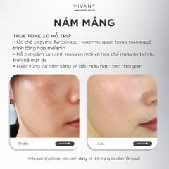 Tinh chất giảm nám, tàn nhang và cải thiện da sáng mịn Vivant Skincare True Tone 2.0 - 30ml