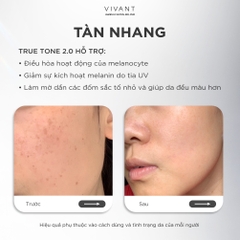 Tinh chất giảm nám, tàn nhang và cải thiện da sáng mịn Vivant Skincare True Tone 2.0 - 30ml