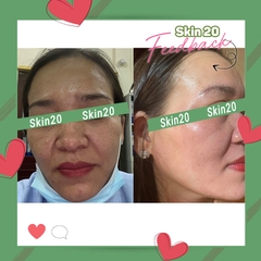 Serum chống oxy hóa, làm sáng đều màu da Obagi Professional C Serum 15% - 30ml