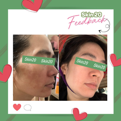 Kem trị nám, trắng da ZO Skin Health Pigment Control + Blending Creme - 80g