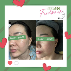 Kem dưỡng phục hồi làm dịu da Obagi Kinetin Hydrating Cream - 50ml