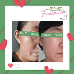 Kem trị sạm nám, dưỡng trắng da Obagi Nuderm Blend Fx (số 5) - 57g