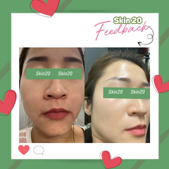 Kem trị sạm nám, dưỡng trắng da Obagi Nuderm Blend Fx (số 5) - 57g