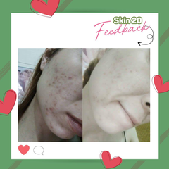 Serum trắng sáng da Kiehl's Clearly Corrective Dark Spot Solution