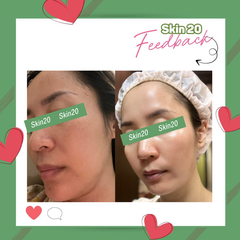 Kem dưỡng sáng da ZO Brightalive Skin Brightener