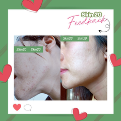 Kem tẩy tế bào chết Obagi Nuderm Exfoderm ( số 4 ) - 57g