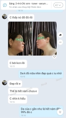 Kem trị sạm nám, dưỡng trắng da Obagi Nuderm Blend Fx (số 5) - 57g