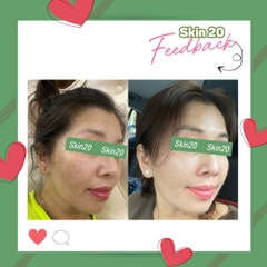 Serum chống oxy hóa, làm sáng đều màu da Obagi Professional C Serum 15% - 30ml