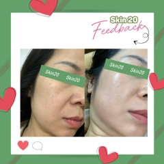 Kem đặc trị nám ZO Skin Health Pigment Control Creme - 80g