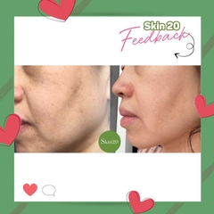Serum chống oxy hóa, làm sáng đều màu da Obagi Professional C Serum 20% - 30ml