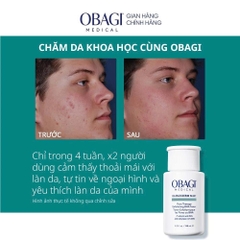 Dung dịch tẩy da chết Obagi Pore Therapy (BHA) - 148ml