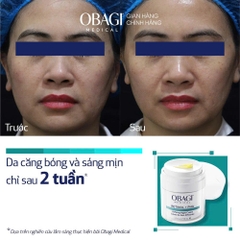 Kem dưỡng tái tạo & trẻ hóa da ban đêm Obagi Retinol + PHA - 50ml